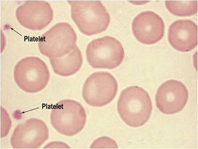platelets blood cells. Red Blood Cells with Platelets