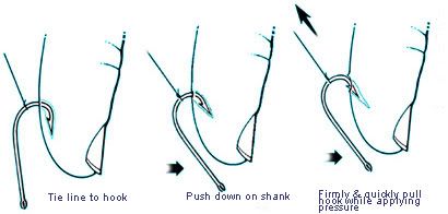 Fish Hook Injuries